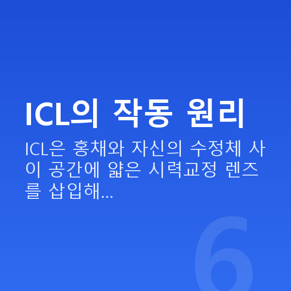 ICL렌즈삽입술원리 ICL의 작동 원리