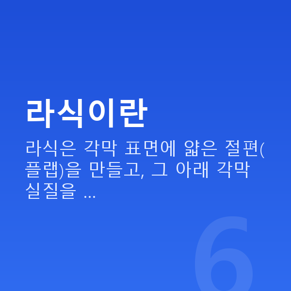 강남라식 라식이란