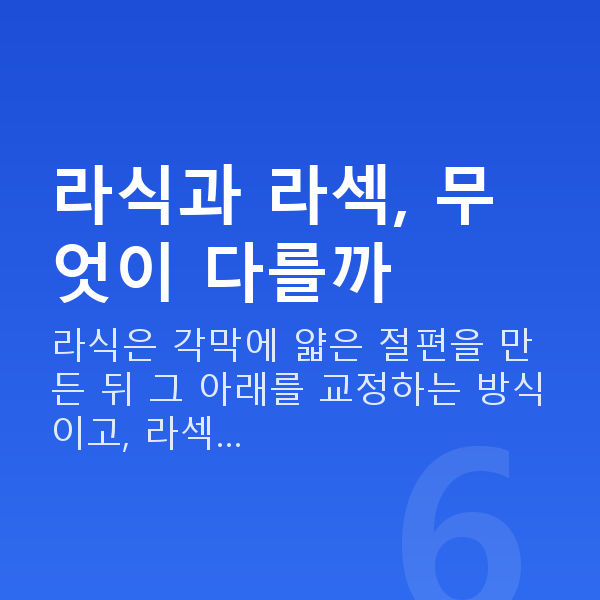 강남라식라섹추천 라식과 라섹, 무엇이 다를까