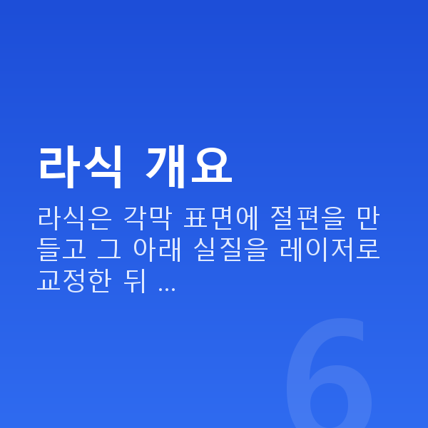 강남역라식 라식 개요