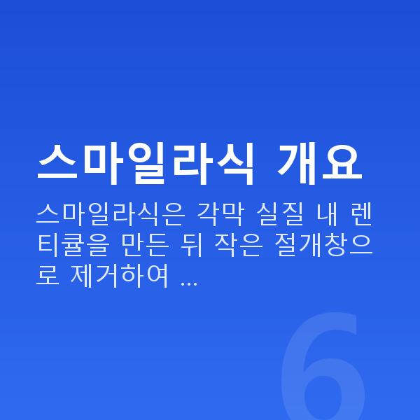 강남역스마일라식 스마일라식 개요