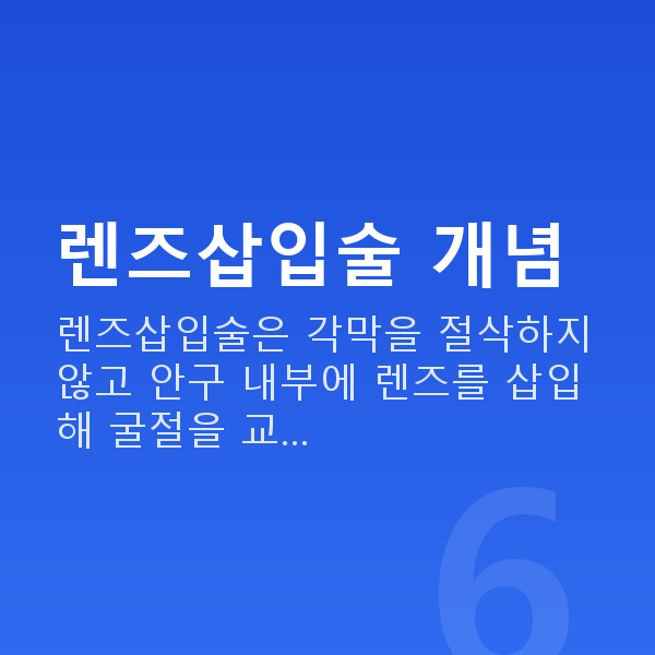 교대렌즈삽입술 렌즈삽입술 개념