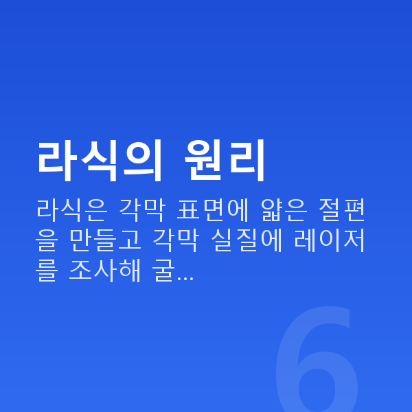 군인라식 라식의 원리