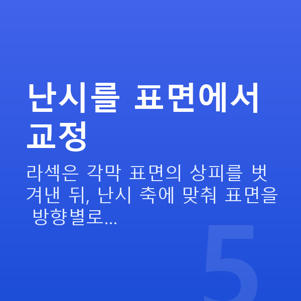 난시라섹 난시를 표면에서 교정