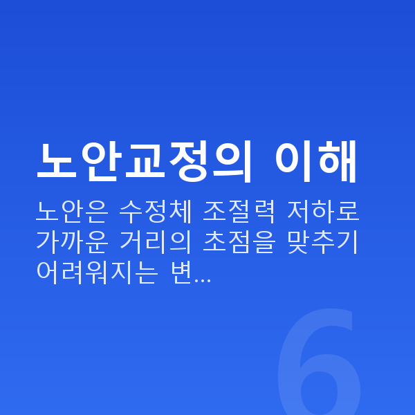 노안교정 노안교정의 이해