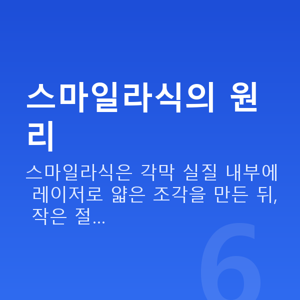 대학생스마일라식 스마일라식의 원리