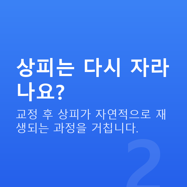 라섹원리 상피는 다시 자라나요?