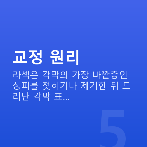 라섹원리 교정 원리