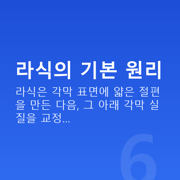라식원리 라식의 기본 원리