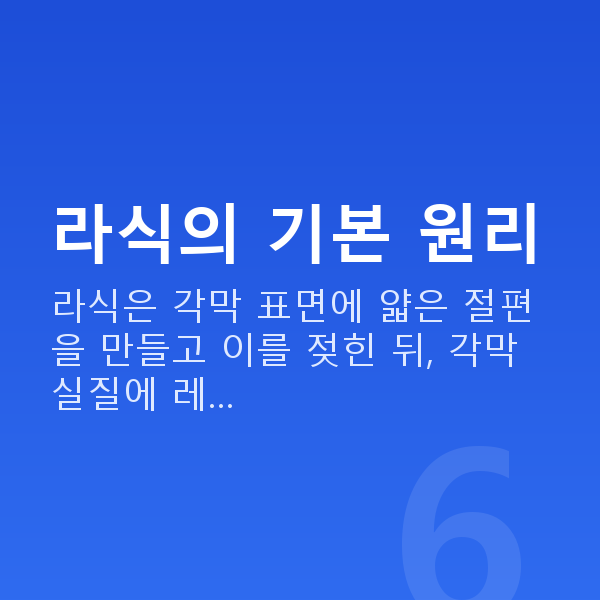 수험생라식 라식의 기본 원리