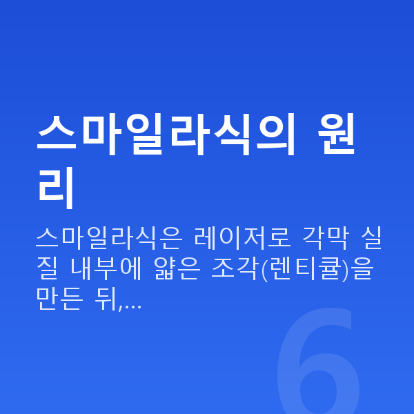 수험생스마일라식 스마일라식의 원리