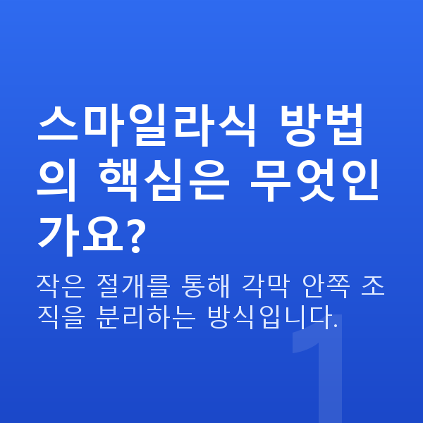 스마일라식방법 스마일라식 방법의 핵심은 무엇인가요?
