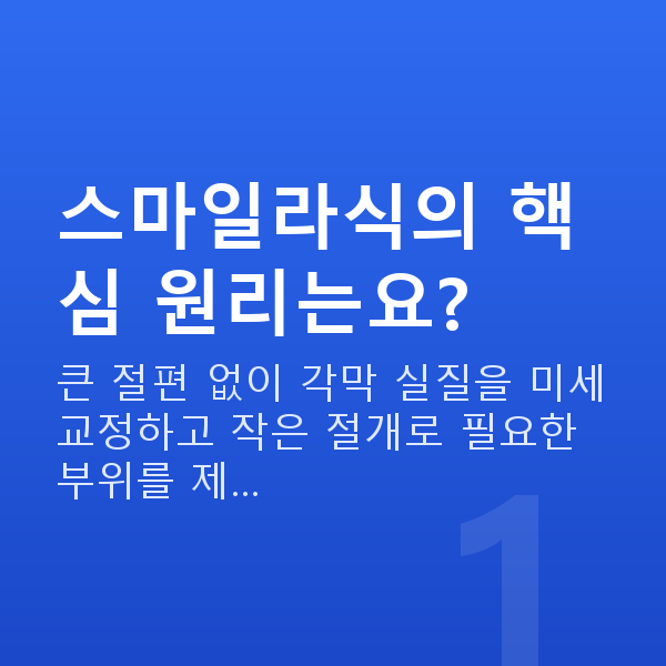스마일라식원리 스마일라식의 핵심 원리는요?