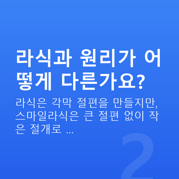 스마일라식원리 라식과 원리가 어떻게 다른가요?