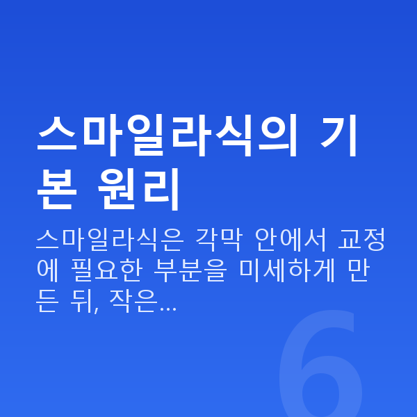 스마일라식원리 스마일라식의 기본 원리