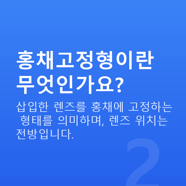 알티산렌즈삽입술 홍채고정형이란 무엇인가요?