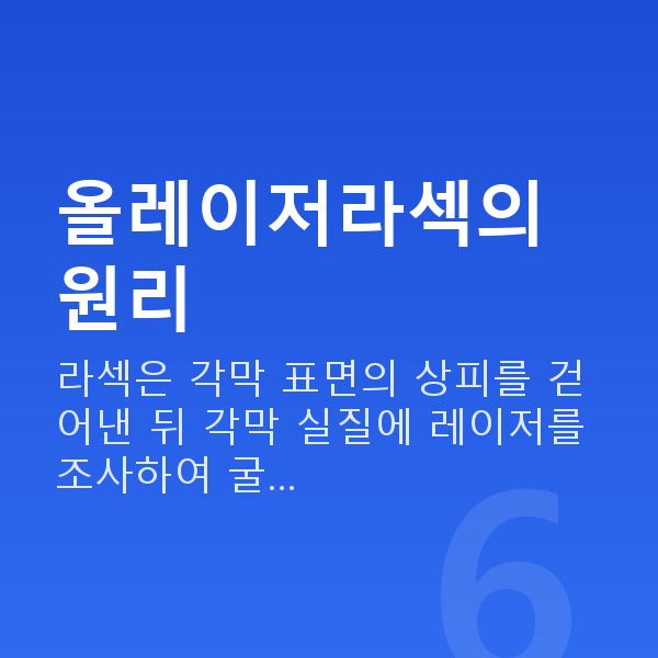 올레이저라섹 올레이저라섹의 원리