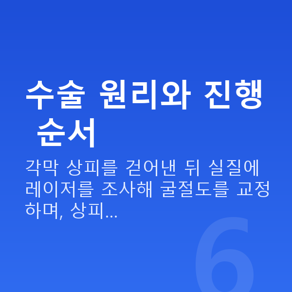 원데이라섹수술방법 수술 원리와 진행 순서