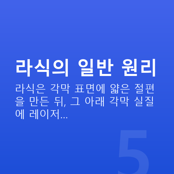 중년라식 라식의 일반 원리
