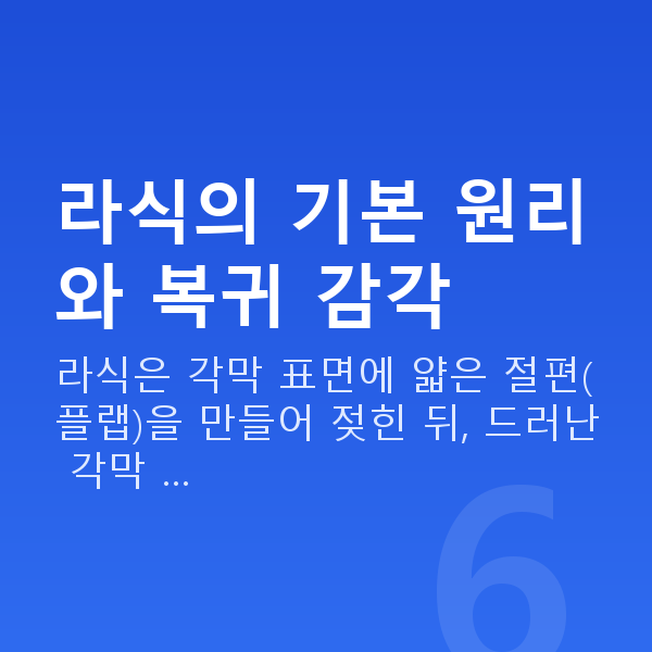 직장인라식 라식의 기본 원리와 복귀 감각
