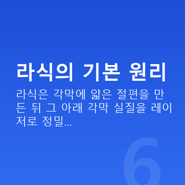 프리미엄라식원리 라식의 기본 원리