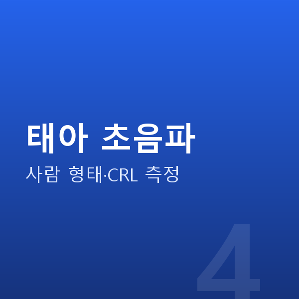 임신 12주차 태아 초음파