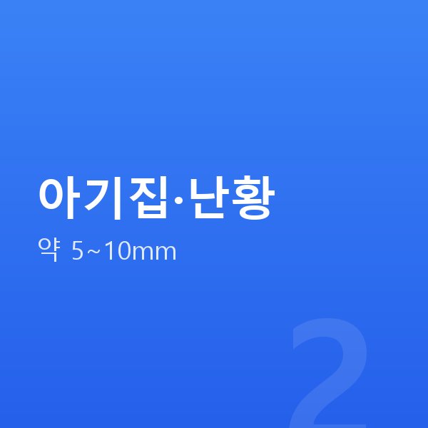 임신 5주차 아기집·난황