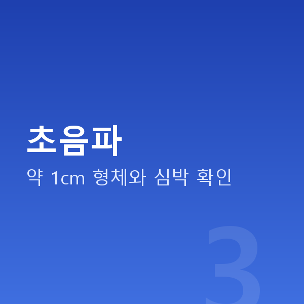 임신 7주차 초음파