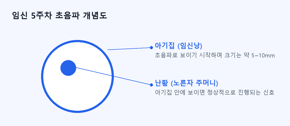 임신 5주차 초음파 개념도 — 아기집(임신낭)과 난황