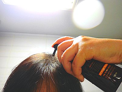 두피각질 — 신경 쓰이는 각질, 상담으로 확인